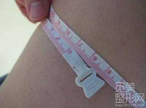 大腿吸脂术后2个月