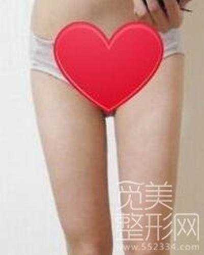 大腿吸脂术后7个月