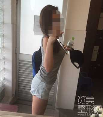 全身吸脂术后7个月的记录