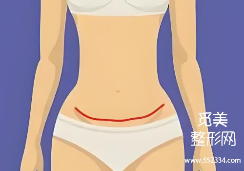 西安腹壁整形崔鑫医生好吗？了解一下医生信息、坐诊医院等资料