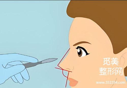 上海九院整形科鼻子价目表！附25年详细价格表