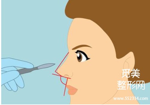 常州一院整形科鼻子怎么样?在当地排于前列