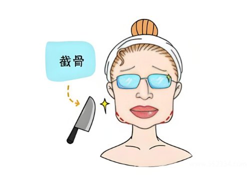 郑大二附院整形科磨骨怎么样？实力技术剖析