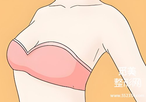 昆明附二院整形科丰胸怎么样？基本信息、案例等一览