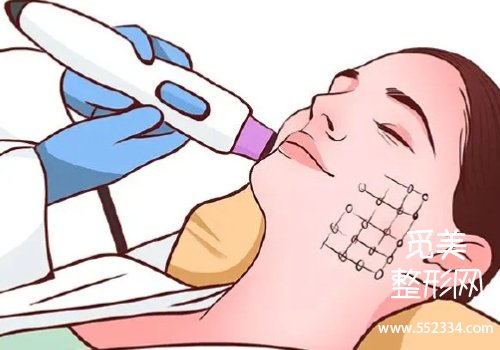 湘雅二整形科有热玛吉吗?医院实力很强