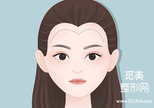 开封人民医院整形科植发怎么样?基本信息、擅长项目等分析