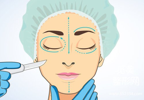 上海眼整形吴海龙好吗?技术沉稳、审美在线!附价格明细