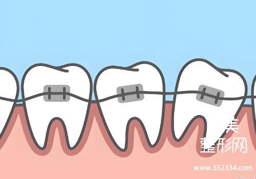 深圳世纪河山口腔价目表!技术口碑点评、25年价格明细公布