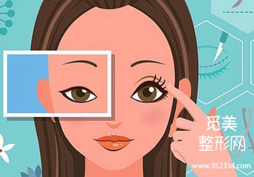 广州博研双眼皮怎么样做？凭借专业的技术以及贴心的服务脱颖而出