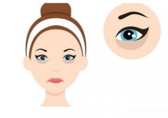 成都晶肤医院袪眼袋价格公布！技术特色、25年价格一览